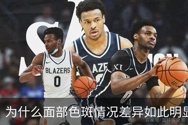 为什么面部色斑情况差异如此明显？